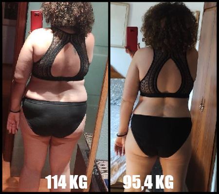 comparativa_espalda_5