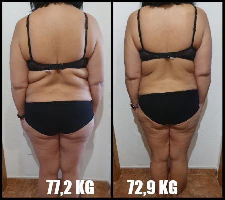 comparativa_espalda_6