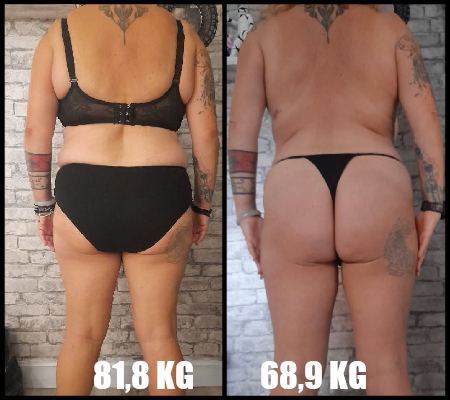comparativa_espalda_7