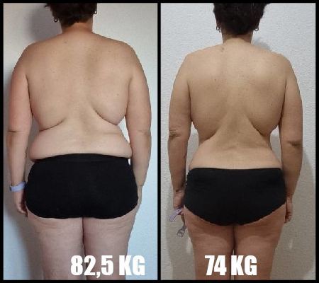 comparativa_espalda_8